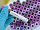 Monaco: 4 nuovi casi per un totale di 27 affetti da Coronavirus