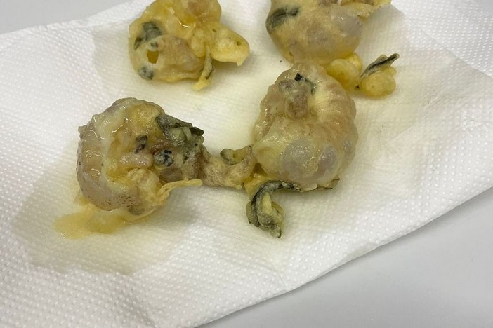 La frittella di meduse (Twitter) La frittella di meduse (Twitter)