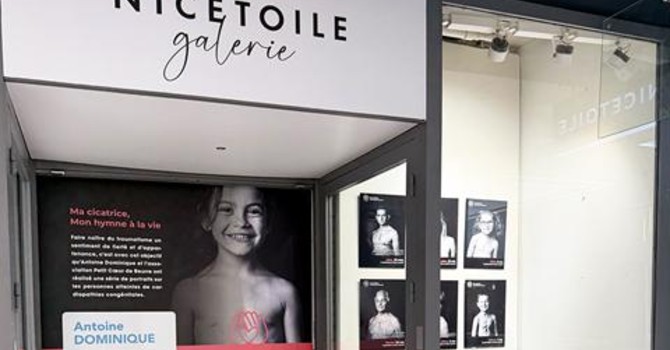 Ma cicatrice, mon hymne à la vie - Associazione Petit Cœur de Beurre e il fotografo Antoine Dominique - Nicetoile Ma cicatrice, mon hymne à la vie - Associazione Petit Cœur de Beurre e il fotografo Antoine Dominique - Nicetoile