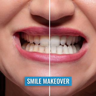 La rivoluzione dello Smile Makeover: l'eccellenza estetica e funzionale dell'odontoiatria moderna La rivoluzione dello Smile Makeover: l'eccellenza estetica e funzionale dell'odontoiatria moderna