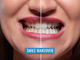 La rivoluzione dello Smile Makeover: l'eccellenza estetica e funzionale dell'odontoiatria moderna La rivoluzione dello Smile Makeover: l'eccellenza estetica e funzionale dell'odontoiatria moderna