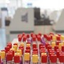 Cos'è il batterio mangiacarne sotto la lente a Messina, minaccia in crescita per il caldo record Cos'è il batterio mangiacarne sotto la lente a Messina, minaccia in crescita per il caldo record