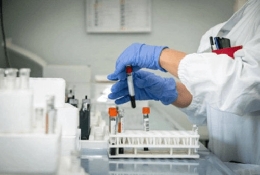 Cancro al pancreas, un nuovo farmaco raddoppia il periodo di sopravvivenza: lo studio Cancro al pancreas, un nuovo farmaco raddoppia il periodo di sopravvivenza: lo studio
