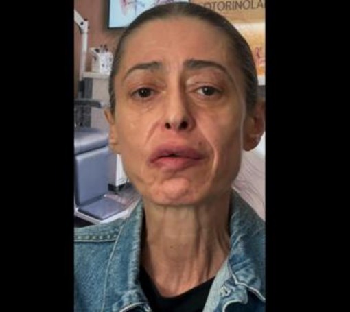 Gerardina Trovato annulla il tour: "Devo operarmi d'urgenza" Gerardina Trovato annulla il tour: "Devo operarmi d'urgenza"