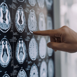 Tumori: glioma, Fda riconosce come farmaco orfano l'isotopo rame-64 sviluppato nelle Marche Tumori: glioma, Fda riconosce come farmaco orfano l'isotopo rame-64 sviluppato nelle Marche