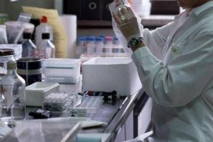 Malattie rare - fenilchetonuria, Cazzorla (Ao Padova): "Più qualità di vita con nuove cure" Malattie rare - fenilchetonuria, Cazzorla (Ao Padova): "Più qualità di vita con nuove cure"