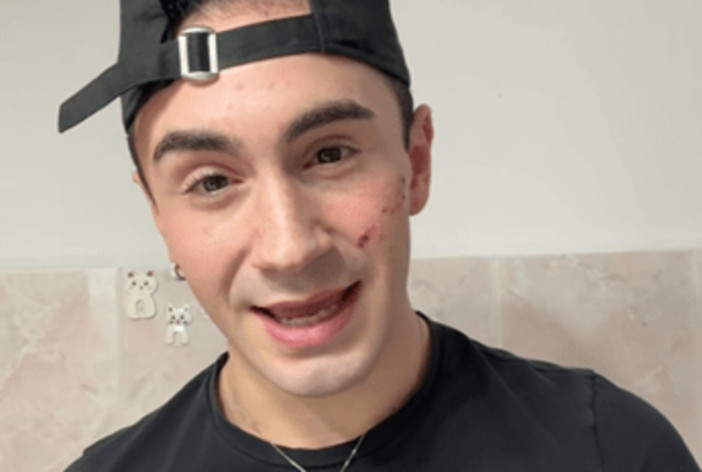 Genova, 19enne denuncia aggressione omofoba: "Sfregiato al viso con coltellino"