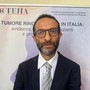 Tumore rinofaringeo, Bossi (Humanitas): "Più ricerca in Europa e cooperazione con la Cina" Tumore rinofaringeo, Bossi (Humanitas): "Più ricerca in Europa e cooperazione con la Cina"