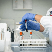 Cancro al pancreas, un nuovo farmaco raddoppia il periodo di sopravvivenza: lo studio
