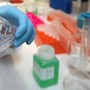 Cancro alla vescica, Berardi (Aiom): "Sangue nelle urine segnale da non sottovalutare"