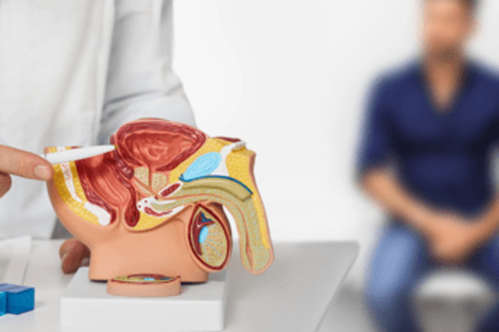 Tumore prostata ad alto rischio recidiva, nuova terapia riduce del 58% rischio morte o metastasi Tumore prostata ad alto rischio recidiva, nuova terapia riduce del 58% rischio morte o metastasi